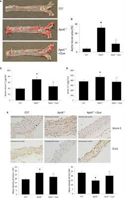 Quercetin Attenuates Atherosclerosis via Modulating Oxidized LDL-Induced Endothelial Cellular Senescence